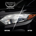 CERAKOTE® Ceramic Headlight Restoration Kit – Guaranteed To Last As Long As You Own Your Vehicle – Brings Headlights Back to Like New Condition - No Power Tools Required - 10 Wipe Kit