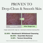 ARENCIA Korean Rice Mochi Face Cleanser - Face Wash, Gentle Scrub All in One for Deep Cleansing, Moisturizing, Pore Minimizing, Acne-Prone Skin, Removing Blackhead with Rice Water & Green Tea
