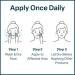 QRxLabs Salicylic & Glycolic Acid Pads (2% Salicylic & 10% Glycolic) - Acne Pads for Face & Bacne with Vitamins B5, C & E, Calendula & Green Tea - Face Exfoliator - 50 Count Jar