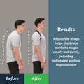 ComfyBrace Posture Corrector Back Brace for Men and Women Adjustable