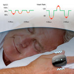 Wellue O2Ring Oxygen Monitor with Bluetooth and Vibration Reminder