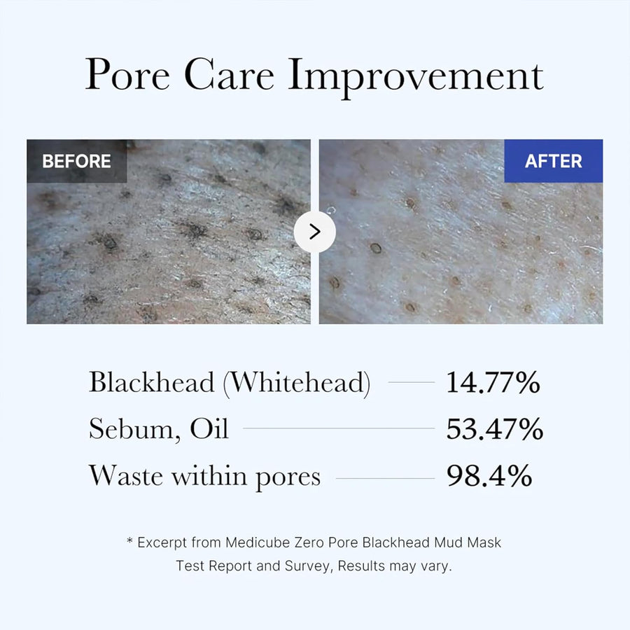 Medicube Zero Pore Blackhead Mud Facial Mask - Skin Cooling & Pore Tightening - 3 Minute Quick Dry Formula with AHA, BHA, PHA, and Pore-Purifying Clay - Korean Mud Mask 3.52 oz