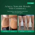 Lymphatic Drainage Supplement with Dandelion, Burdock, Cleavers & Echinacea