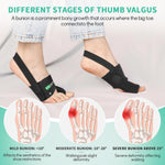 Healrecux Bunion Corrector for Women and Men, 1 Pair, Big Toe Straightener