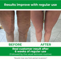 TESMED Manual Cellulite Massager Made in Italy with Converging Roller Technology