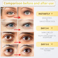 24K Gold Under Eye Patches – 60pcs for Dark Circles, Puffiness & Wrinkles Care
