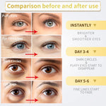 24K Gold Under Eye Patches – 60pcs for Dark Circles, Puffiness & Wrinkles Care