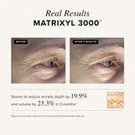 Asterwood Triple Repair Matrixyl 3000 + Argireline + Hyaluronic Acid + Vitamin C Serum for Face - Anti-Aging, Collagen Boosting, Hydrating - Fragrance-Free - 1 Fl Oz
