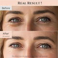 Beauty of Joseon Revive Eye Serum with Retinal Niacinamide Peptide for Face Under Eyes Wrinkles Dark Circles Moisturizer Cream Korean Skincare 30ml, 1 fl.oz * 2pack